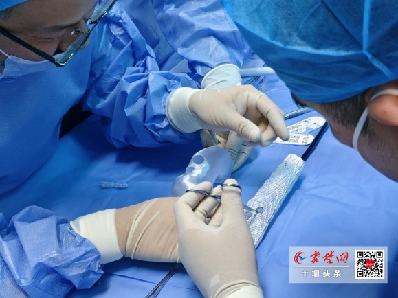 3D打印技术助力复杂手术，十堰人医为89岁高龄患者拆除动脉瘤