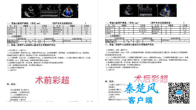 高龄高危瓣膜病，不换瓣也能获新生！十堰这家医院给出更优解